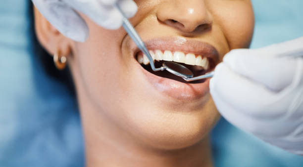 Best Emergency Dental Extractions in Shawnee, OK