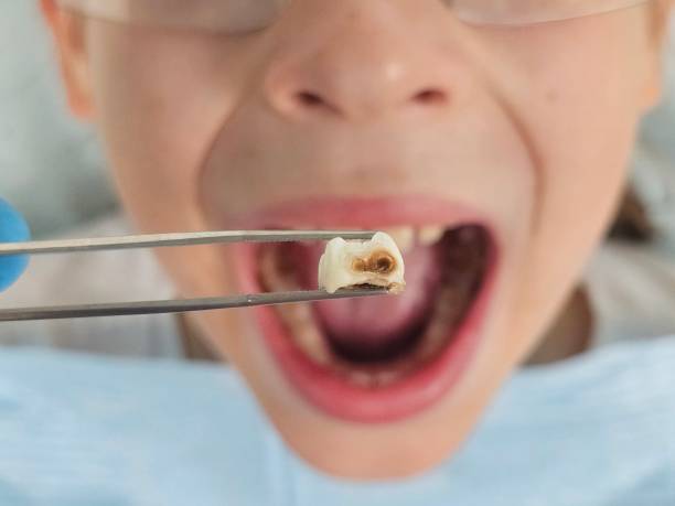 Best Weekend Emergency Dentist in Shawnee, OK