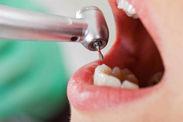 Best Orthodontic Emergency Dentist in Shawnee, OK